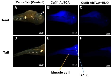 In Vitro and in Vivo Imaging of Nitroxyl with Copper Fluorescent Probe ...