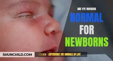 Palm Creases In Newborns: What's Normal? | ShunChild