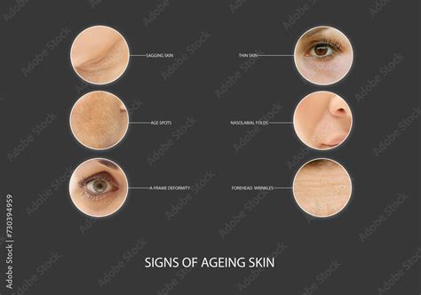 Aging Sign 的图像结果