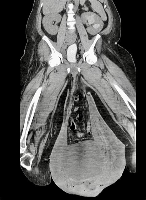 Click image for larger versionName:DE881AEA-49E3-472F-9132-D22350459815 ...