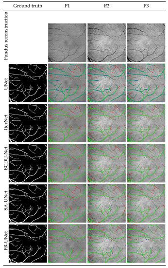 Sensors | Special Issue : Vision- and Image-Based Biomedical Diagnostics