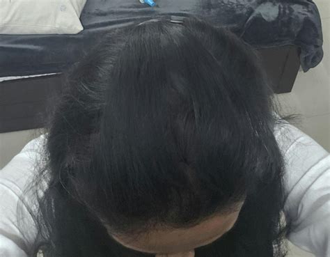 Buy 2.5X3 Inch Silk Hair Topper with Bangs Online