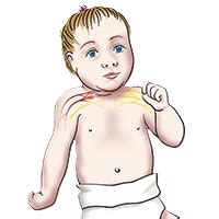 Pediatric Neurosurgeon in Hyderabad | Dr Tarang K Vora