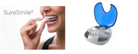Affordable Options for Invisible Aligners Treatment