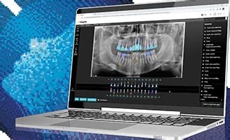 Carestream Dental Support