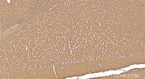 ATP1A1 antibody (83191-6-RR) | Proteintech