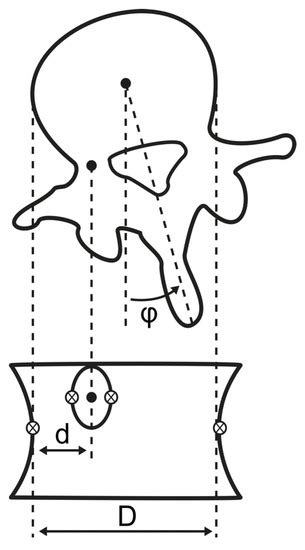 Validity and Absolute Reliability of Axial Vertebral Rotation ...