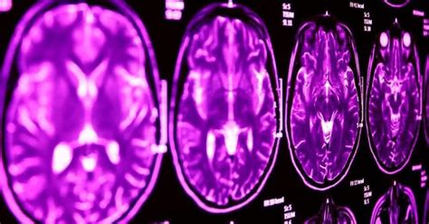 Image result for AVC Video Explicative