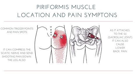 Muscle Pain In Buttocks And Back Of Legs at Robin Walker blog