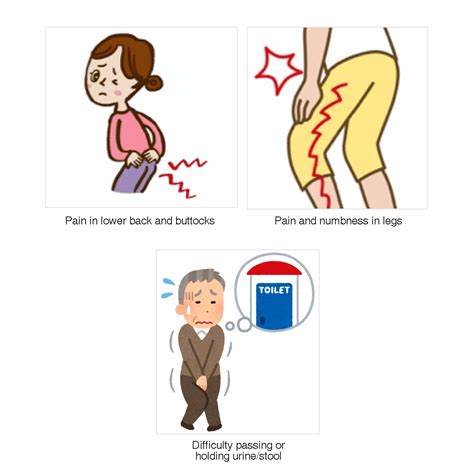 ILC's Treatment for Lumbar Disc Herniation | International Lumbago Clinic