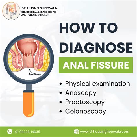 Diagnosing Anal Fissures: A Comprehensive Guide - Dr. Husain Gheewala - Colorectal Surgeon in Mumbai