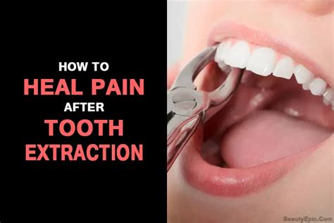 Image result for Tooth Extraction Pain Relief