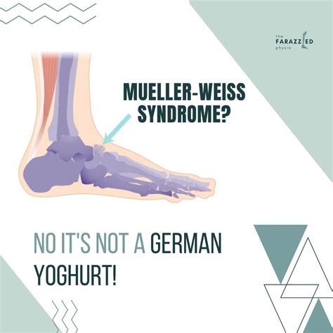 👀👀Mueller Weiss Syndrome👀👀 Mueller Weiss Syndrome is a rare, under-diagnosed cause of chronic ...