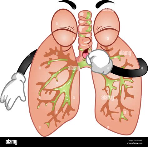 Phlegm Lungs