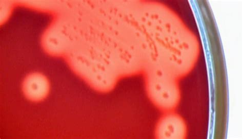 STREP 的图像结果