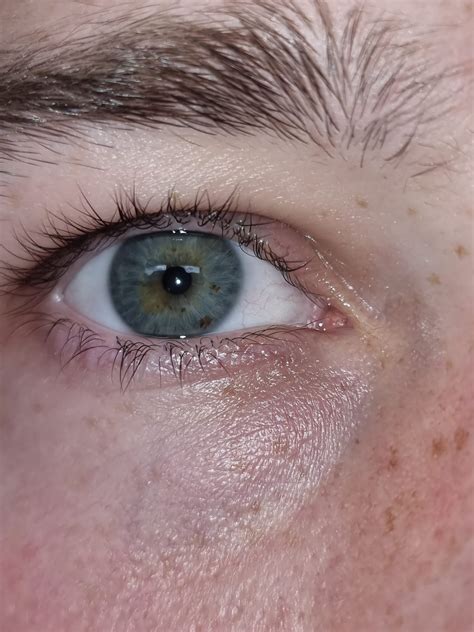Serious eye freckles happening here : r/eyes