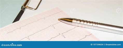 Image result for ECG Graph Paper