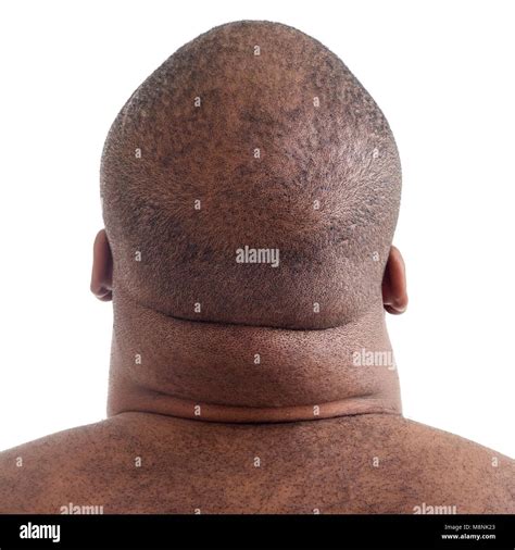Close up of overweight man's neck, rear view Stock Photo - Alamy