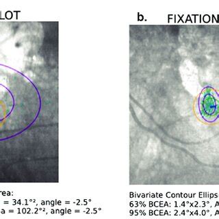 Image result for Role Fixation