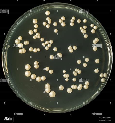 Close-up of candida albicans yeast colonies growing on a petri dish in a microbiology laboratory ...