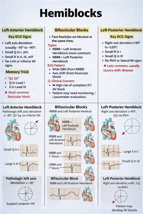 Hemiblock In Ecg