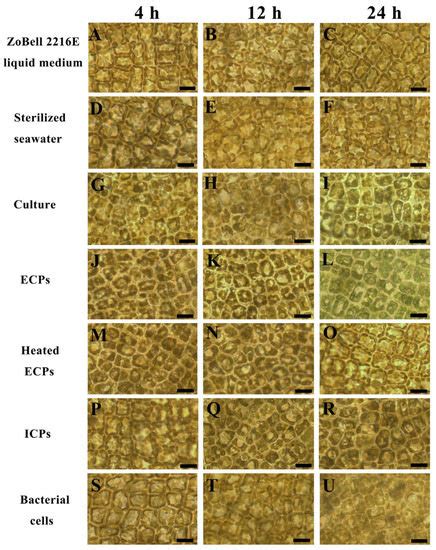 Extracellular Compounds from Pathogenic Bacterium Pseudoalteromonas ...