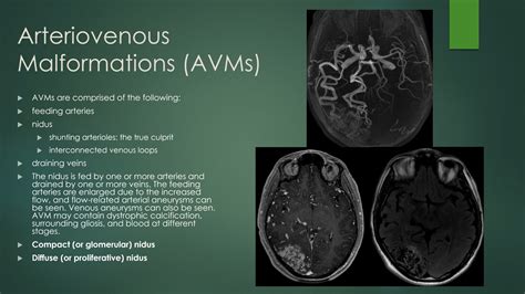 What Is A Small Vascular Malformation at Will Hannah blog