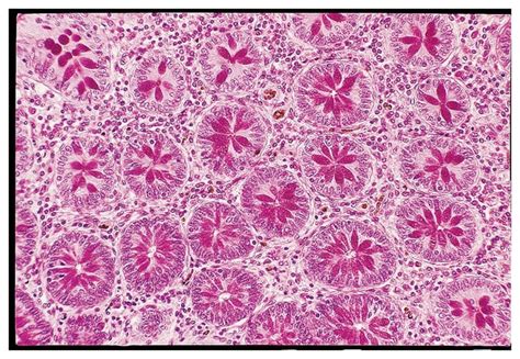 Image result for Bacteria Microscope Slides