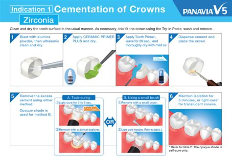 Zirconia Crowns Cementation