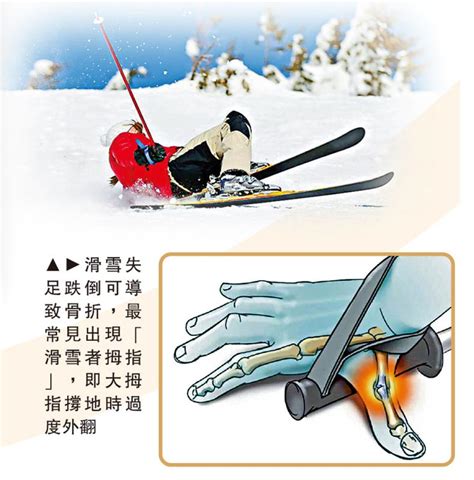 滑雪易伤膝盖，如何保护膝盖？ - 知乎