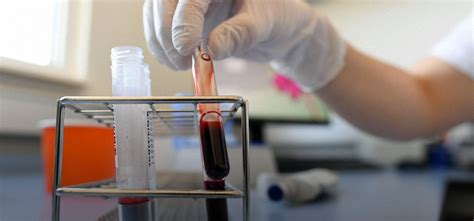 Plasma Therapy Shows Best Result In COVID-19 Treatment In India: All ...