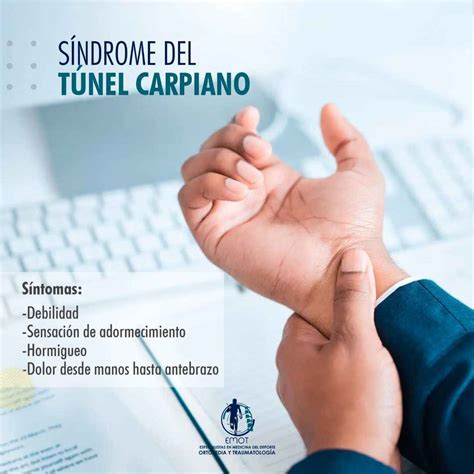 Síndrome del Túnel Carpiano | Dr. Jose Mario Dorantes Rodríguez ...