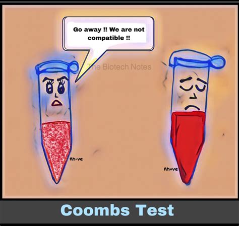 Image result for Coombs Test