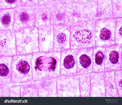 Onion Cell Under Microscope Mitosis at Lois Toussaint blog