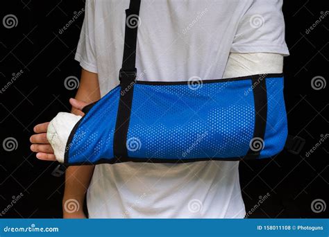 Man with Broken Arm Wrapped Medical Cast Plaster and Blue Bandage ...