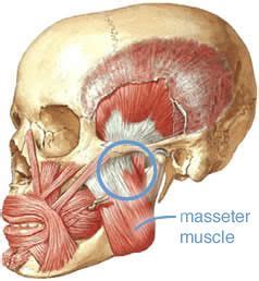 Image result for Masseter Muscle Trigger Point