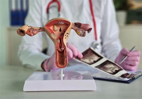Gynecologist examines results of examination of uterus ultrasound ...