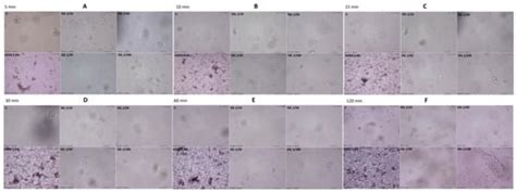 Indoor Inactivation of SARS-CoV-2 Virus by Liquid Hyperoxygen