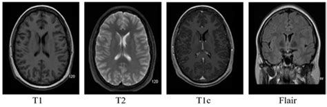 DeepTumor: Framework for Brain MR Image Classification, Segmentation ...