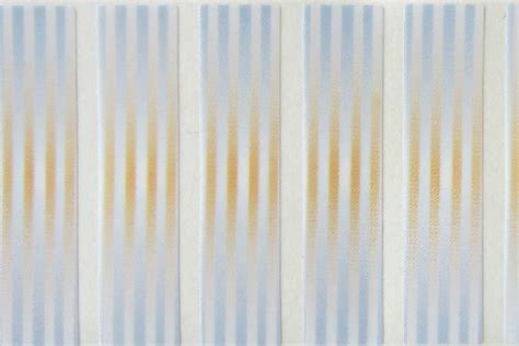 Hot Stamping Foil Labels & Sticker Manufacturer in India