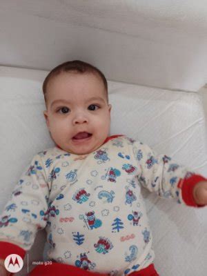 Quiza sea Bizco. angustiada | BabyCenter