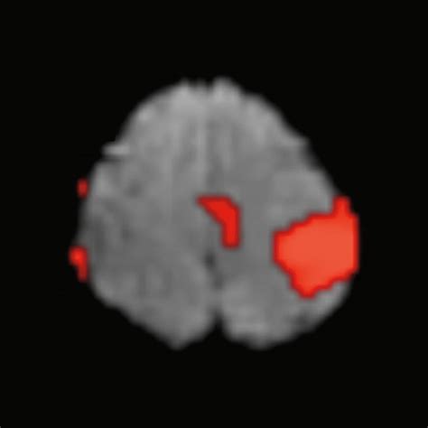 ISMRM 2025 abstracts