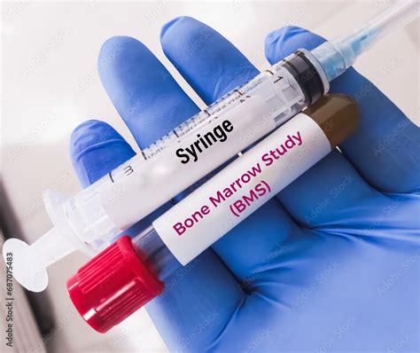 Bone Marrow Testing 的图像结果