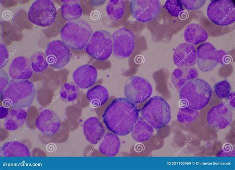 Immature and Mature White Blood Cells Stock Image - Image of hematology ...