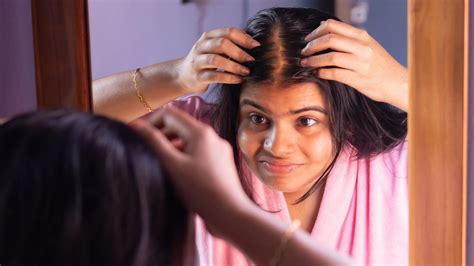 6 Birth Control Pills That Shouldn’t Cause Hair Loss - GoodRx