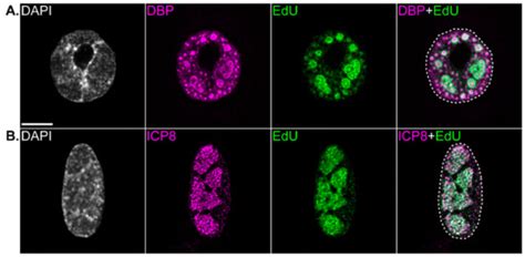 Replication Compartments of DNA Viruses in the Nucleus: Location ...