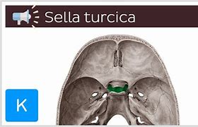 sella turcica 的图像结果