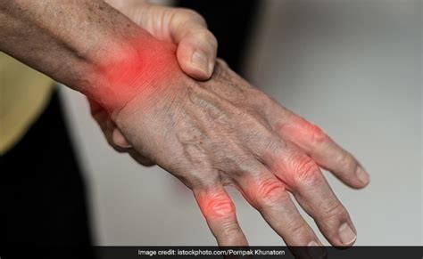 रहने लगा है हड्डियों में दर्द तो इस विटामिन की हो सकती है कमी, जानिए ...