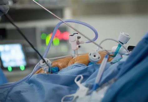 Image result for Intraperitoneal Injection Ovarian Cancer