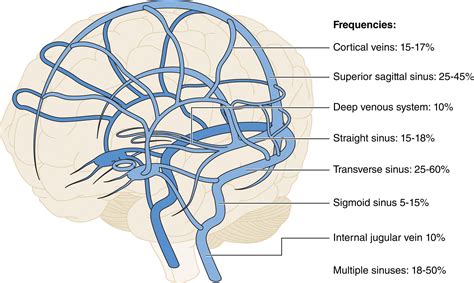 Dural Venous Thrombosis